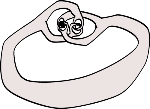 Alexander-horn-sphere